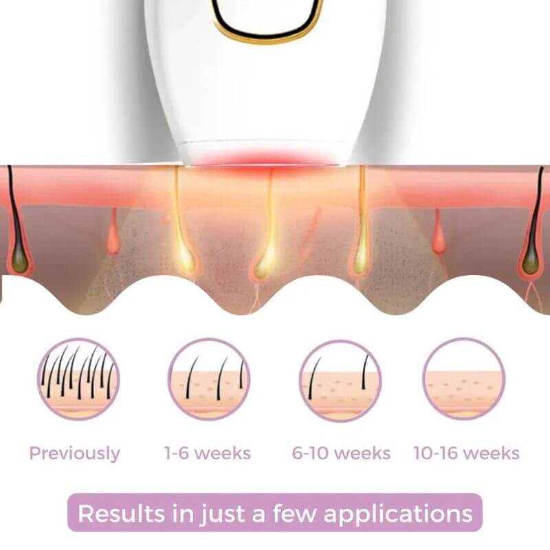 IPL Hair Remover Tool