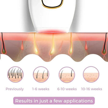 IPL Hair Remover Tool